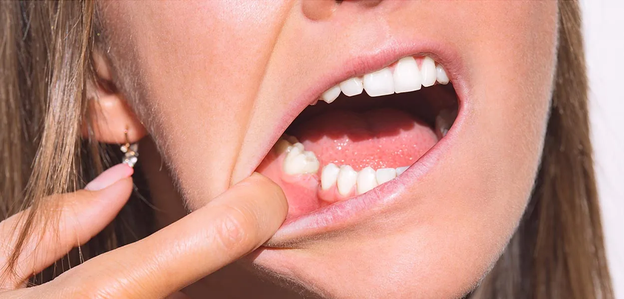 Replacing Missing Teeth: Top Solutions for Long-Term Results