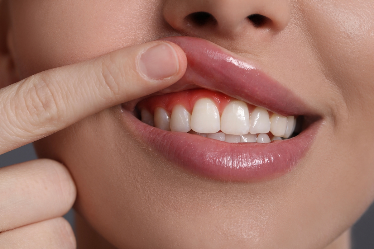 How Gum Disease and Heart Health Are Related: Dr. Mark Berenshteyn Explains
