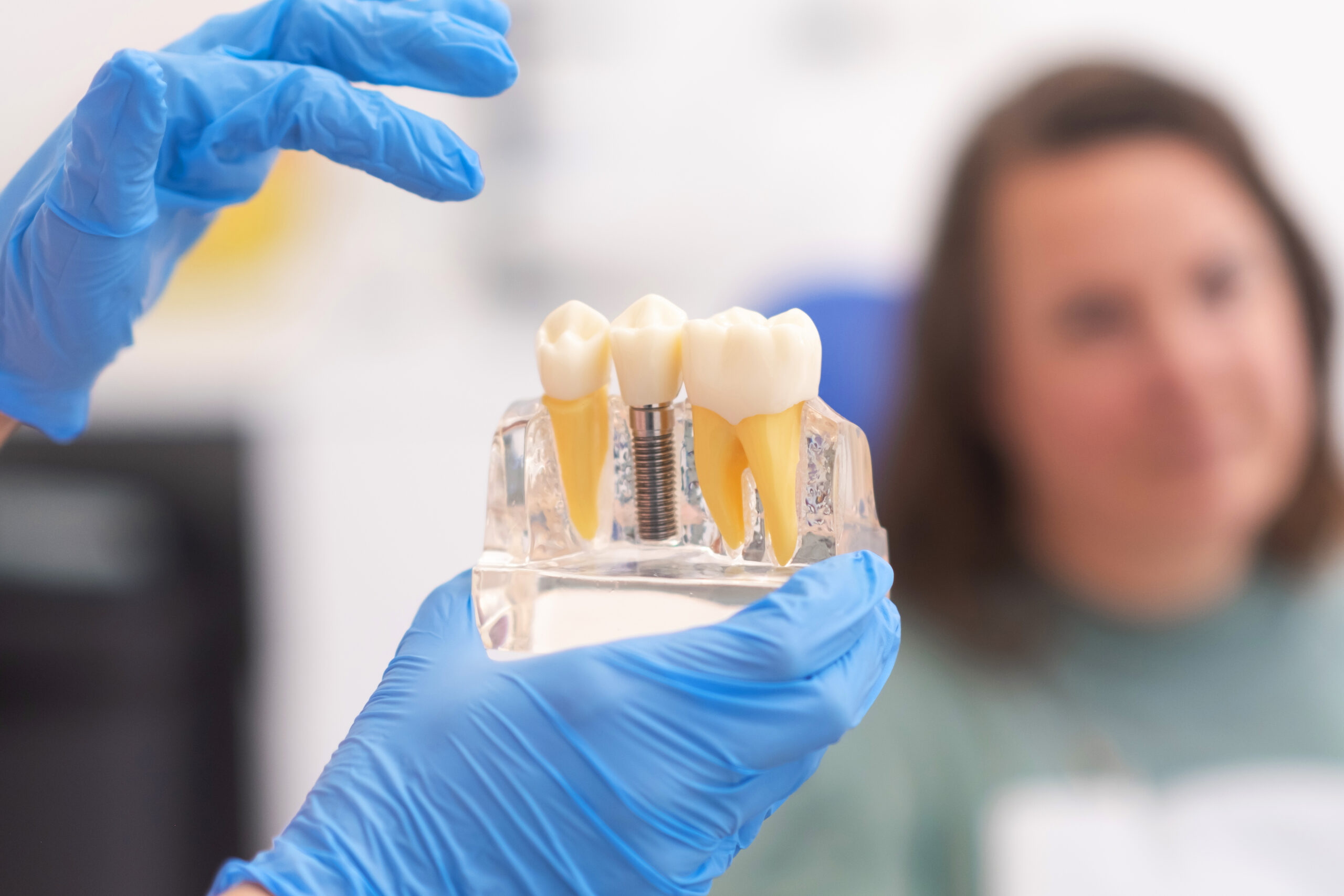 Dental Implant Costs in Fitchburg, MA