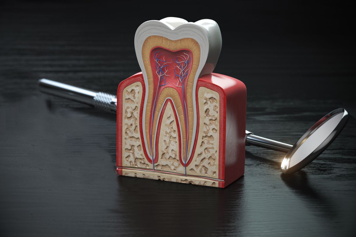 root canal treatment in Fitchburg